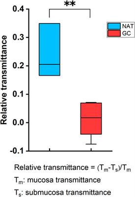 Early detection of gastric cancer via high-resolution terahertz imaging system